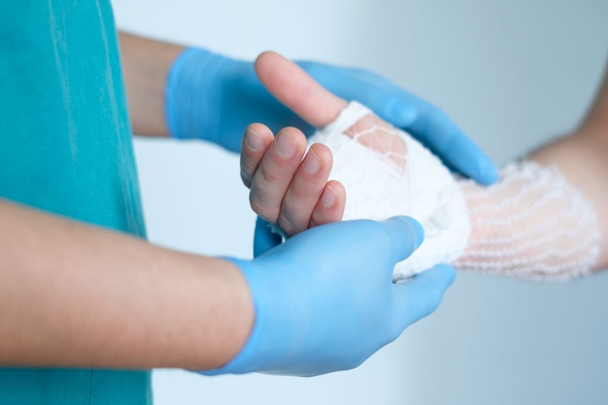 A Comprehensive Guide to Carpal Tunnel Surgery: What You Need to Know