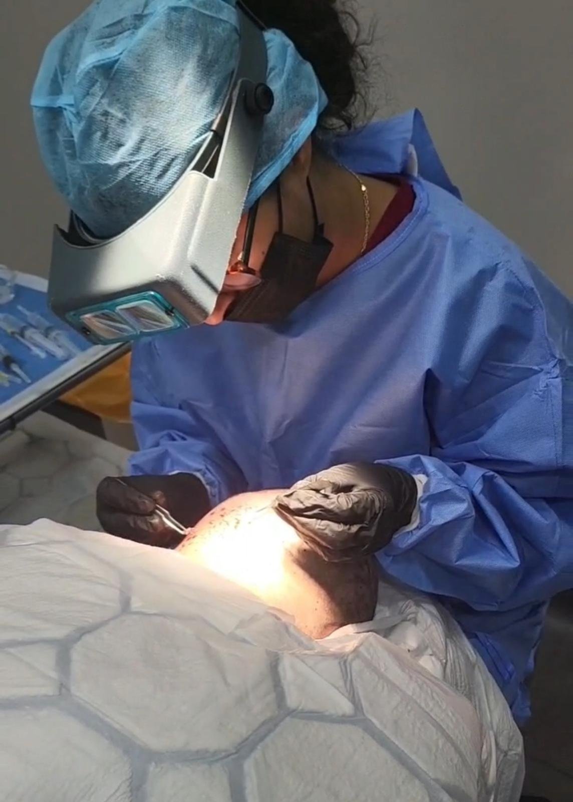 Dr Khaula Safdar performing hair transplant in Cardiff